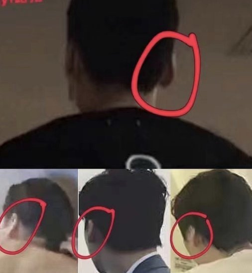 兄弟你咋了？许尔策勒竟然变秃了，三个月前他还有秀发